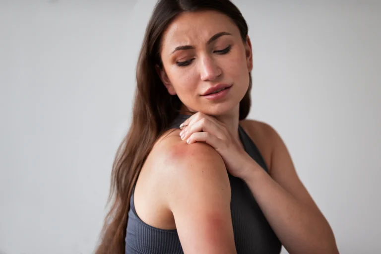 Hidratante para dermatite atopica